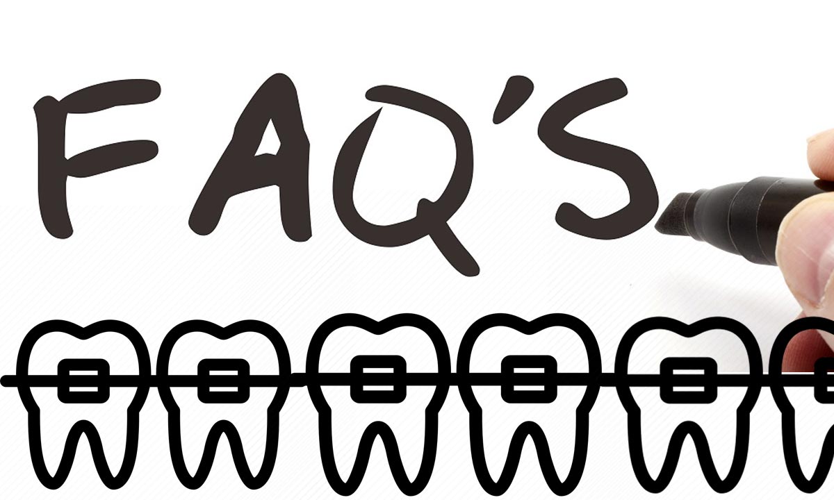 سوالات متداول ارتودنسی دندان