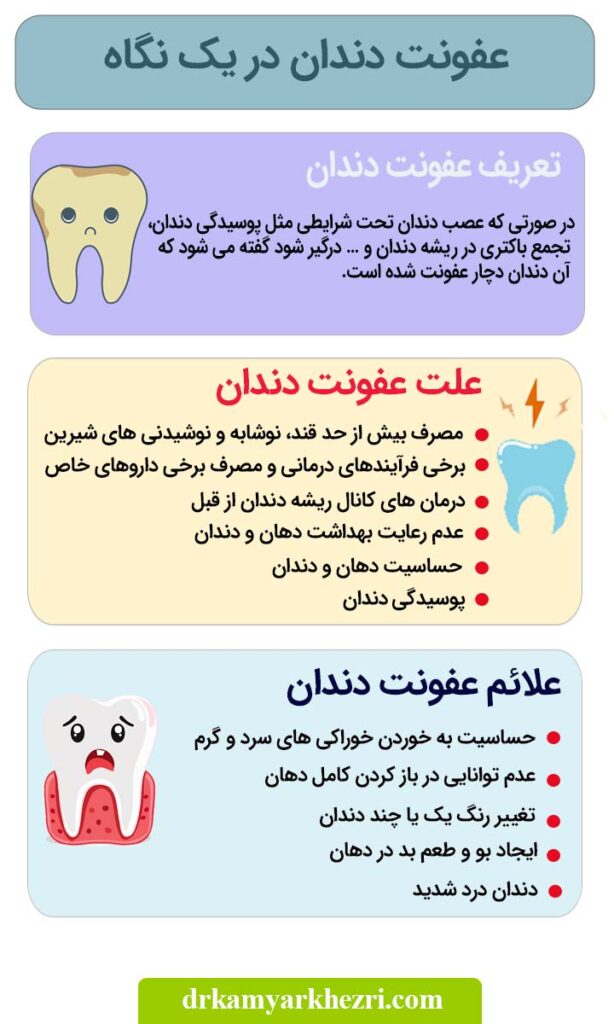 عفونت دندان در یک نگاه