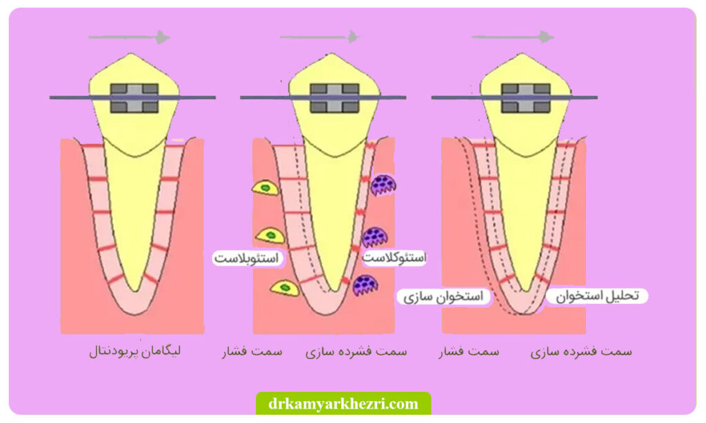 چگونگی حرکت دندان ها در ارتودنسی